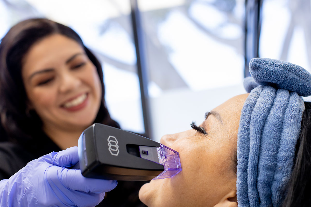 Morpheus8 Glendale, CA Wrinkles Acne Treatment Glendale, CA